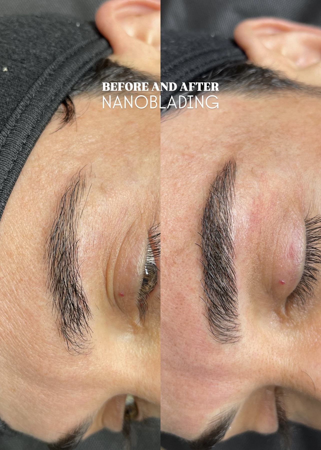 Before and After Nanoblading