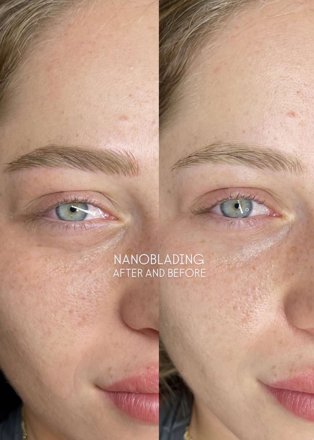 Nanoblading transformation