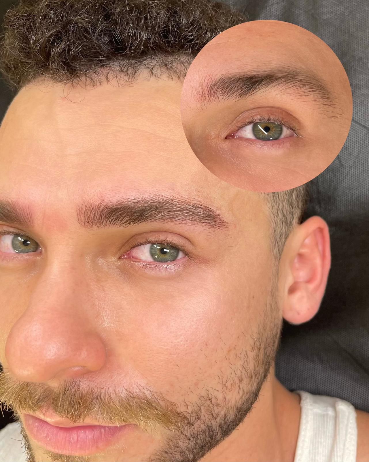 Men's brow transformation